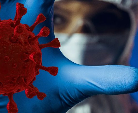 Coronavírus SARS CoV 2 - Plano de contingência - Higiworks